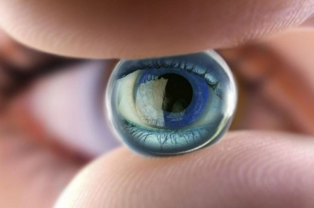 Eye lens