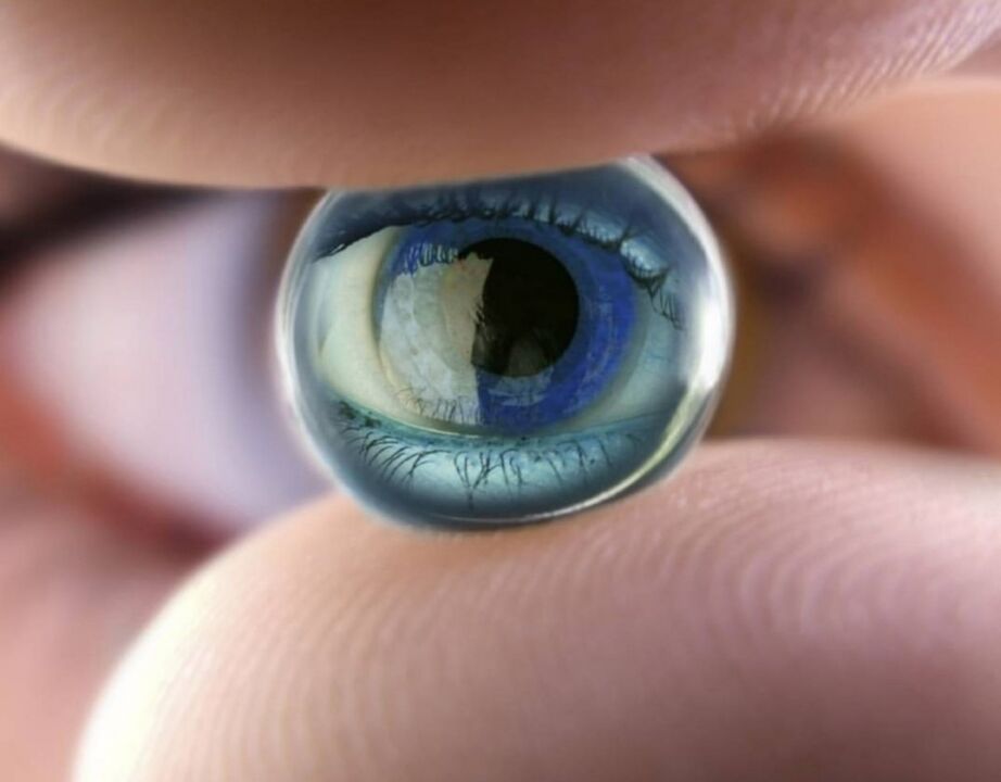 Orthokeratology nighttime lenses will halt progression of vision impairment